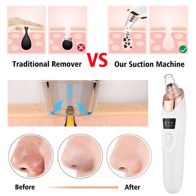 Blackhead Remover Beauty Instrument